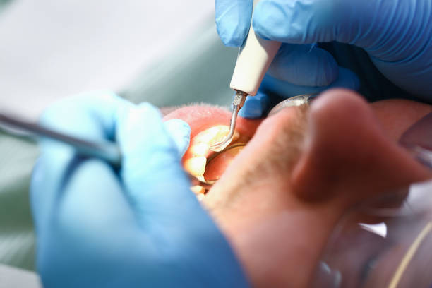 Best Emergency Dentist for Knocked-Out Tooth in Richwood, WV