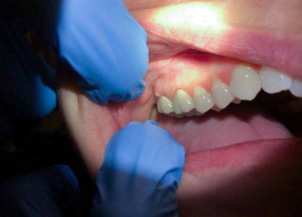 Best Weekend Emergency Dentist in Richwood, WV