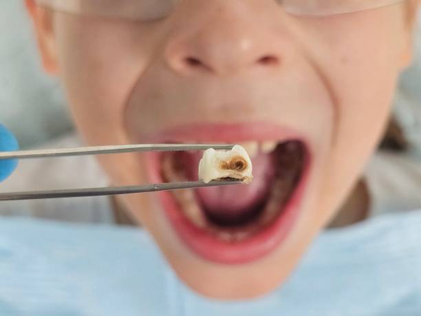 Best Mobile Emergency Dentist in Richwood, WV