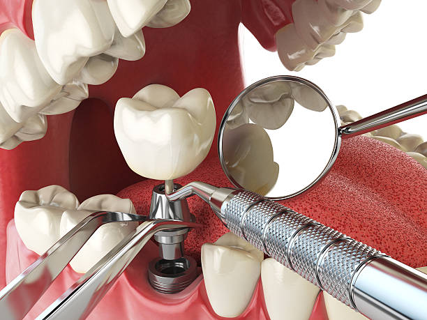 Best Emergency Dentist for Special Needs Patients in Richwood, WV